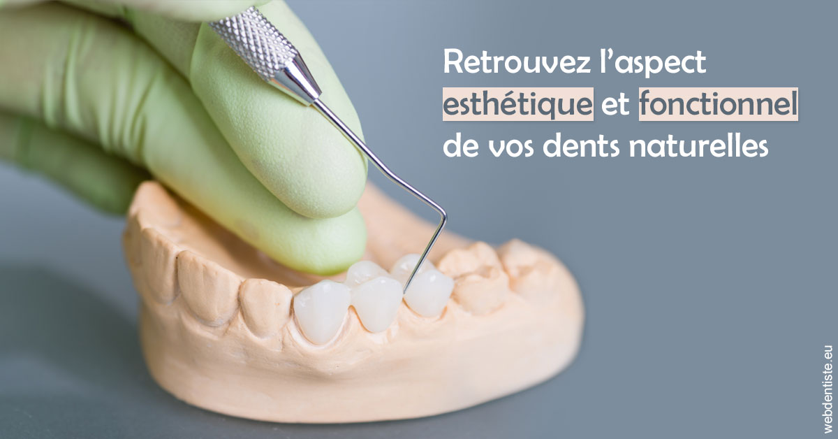 https://dr-riedel-yann.chirurgiens-dentistes.fr/Restaurations dentaires 1