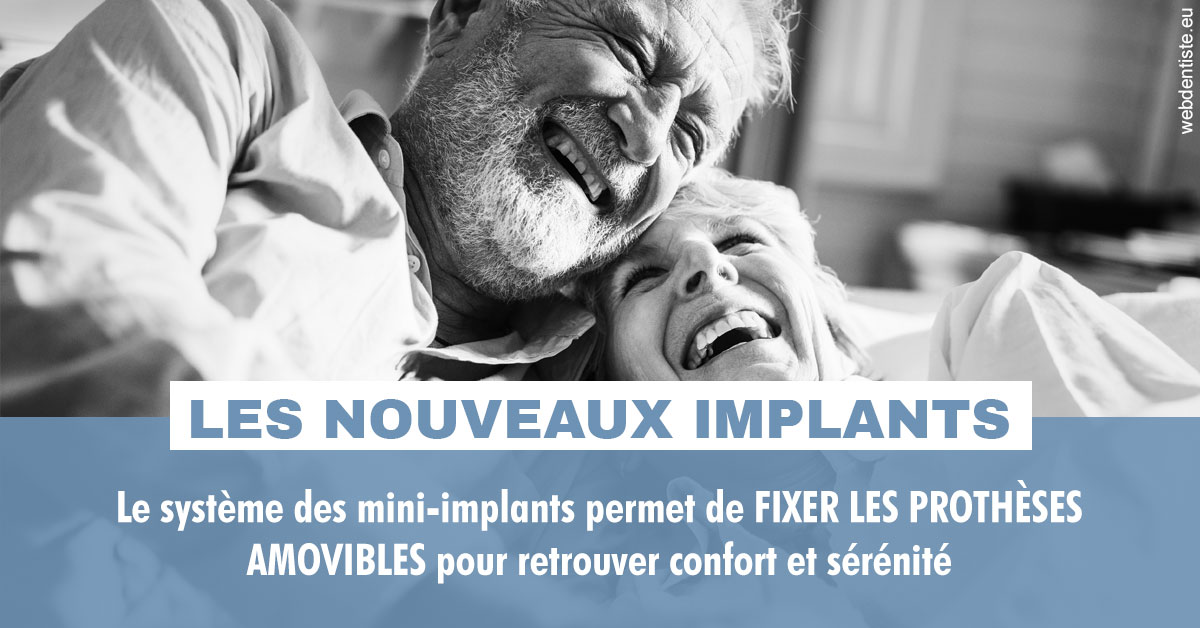 https://dr-riedel-yann.chirurgiens-dentistes.fr/Les nouveaux implants 2