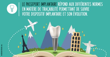 https://dr-riedel-yann.chirurgiens-dentistes.fr/Le passeport implantaire