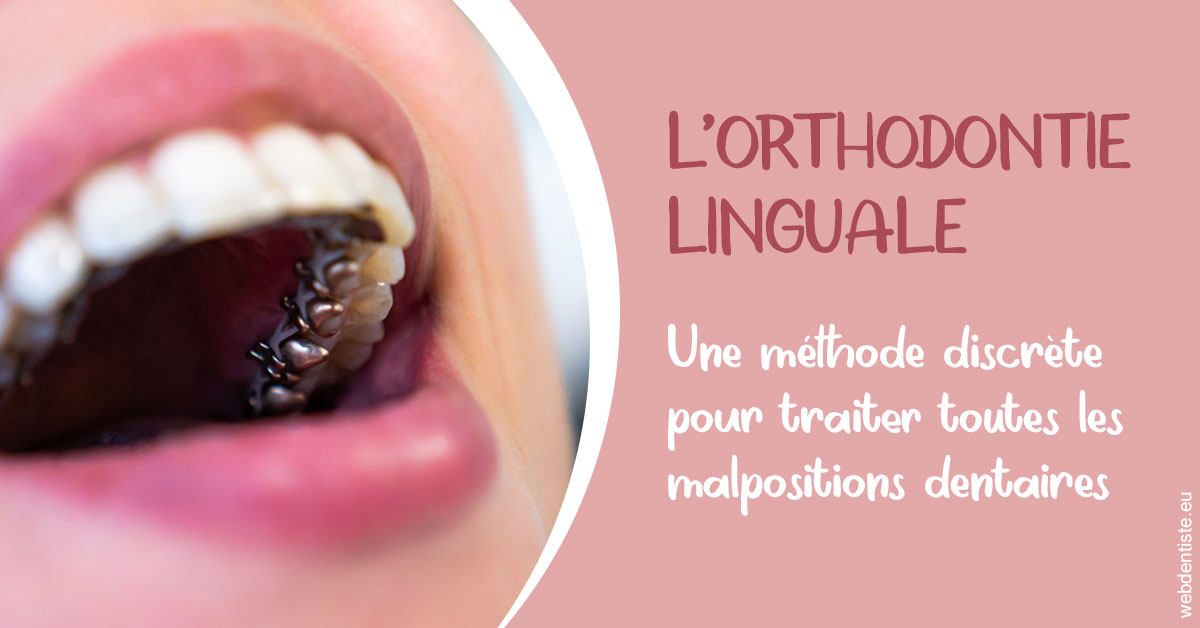 https://dr-riedel-yann.chirurgiens-dentistes.fr/L'orthodontie linguale 2