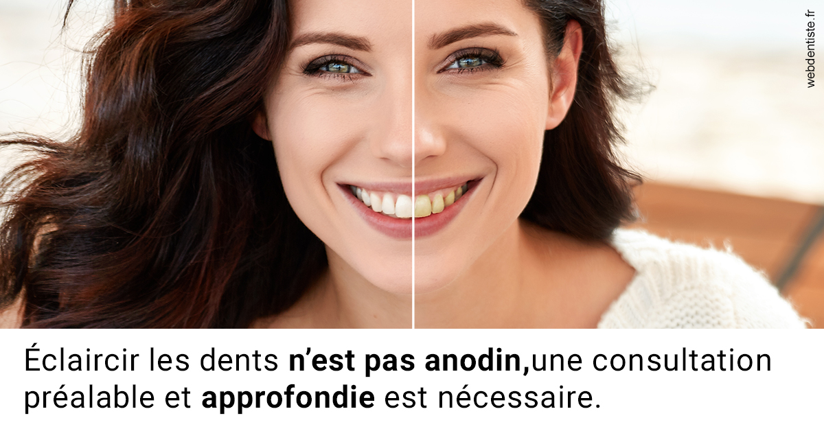 https://dr-riedel-yann.chirurgiens-dentistes.fr/Le blanchiment 2