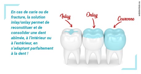 https://dr-riedel-yann.chirurgiens-dentistes.fr/L'INLAY ou l'ONLAY