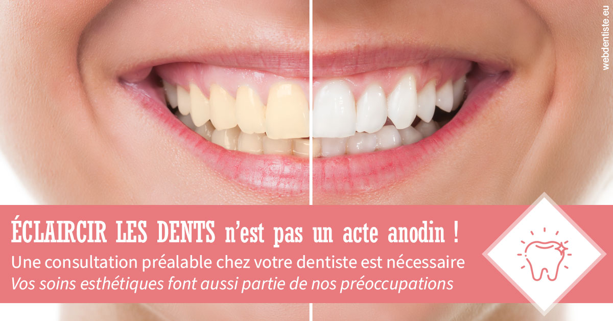 https://dr-riedel-yann.chirurgiens-dentistes.fr/Eclaircir les dents 1