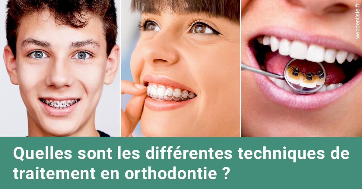 https://dr-riedel-yann.chirurgiens-dentistes.fr/Les différentes techniques de traitement 2