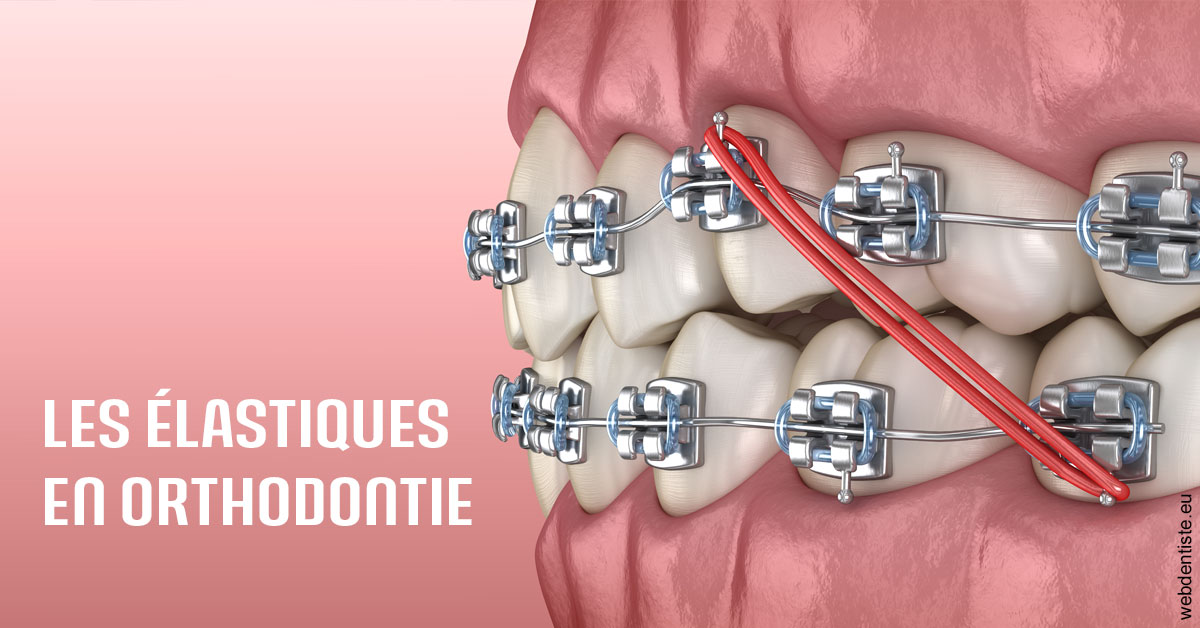 https://dr-riedel-yann.chirurgiens-dentistes.fr/Elastiques orthodontie 2