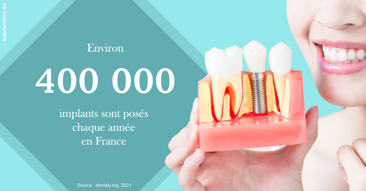 https://dr-riedel-yann.chirurgiens-dentistes.fr/Pose d'implants en France 2